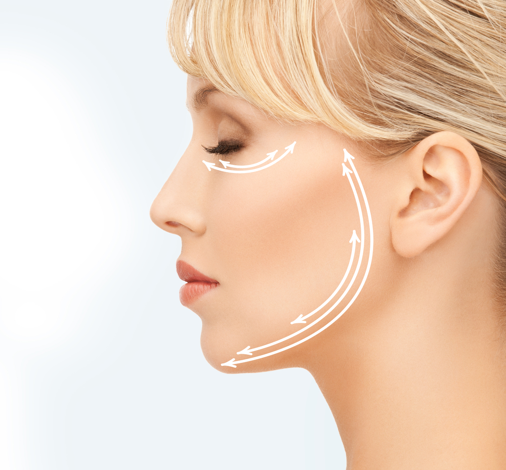 Minimally Invasive Face Lift